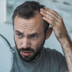 Upset middle aged man with alopecia looking at mirror