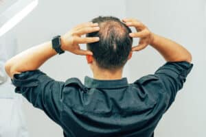 A man with a bald spot on the back of his head